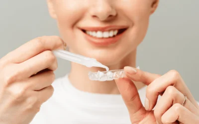 Sbiancamento dentale e sensibilità: come gestire il paziente prima, durante e dopo il trattamento